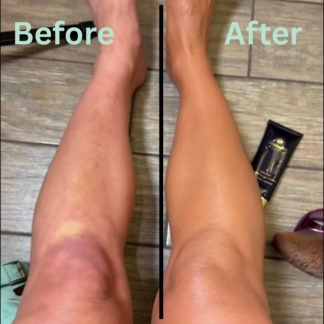 Fembalance™ - Complete Body Concealer for Skin Imperfections, Tattoos & More